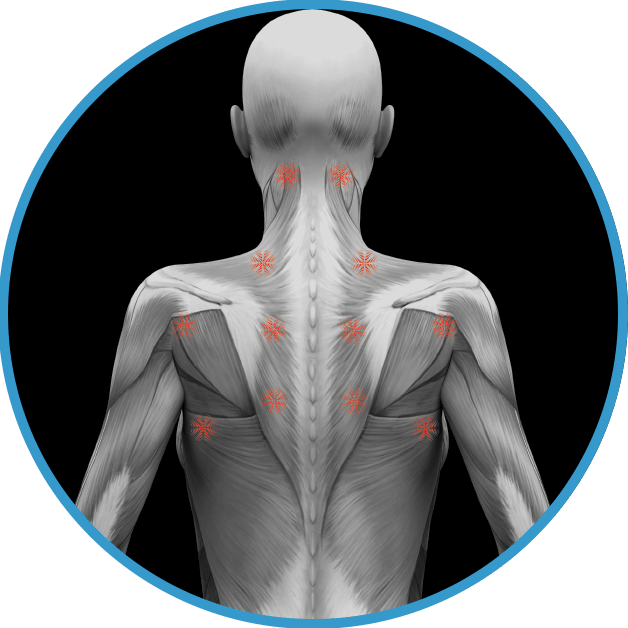What is Neuromuscular Therapy?