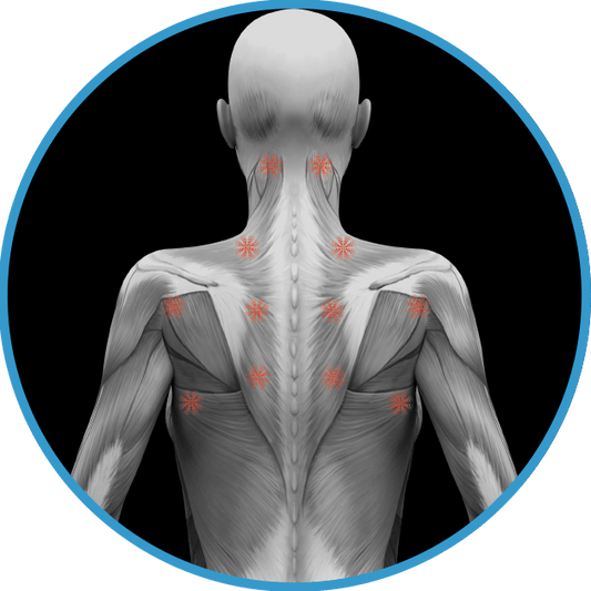 What is Neuromuscular Therapy?